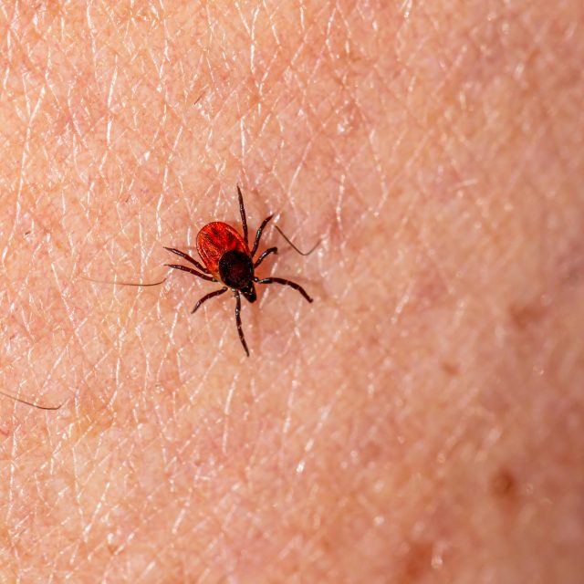 Deer Tick on Skin